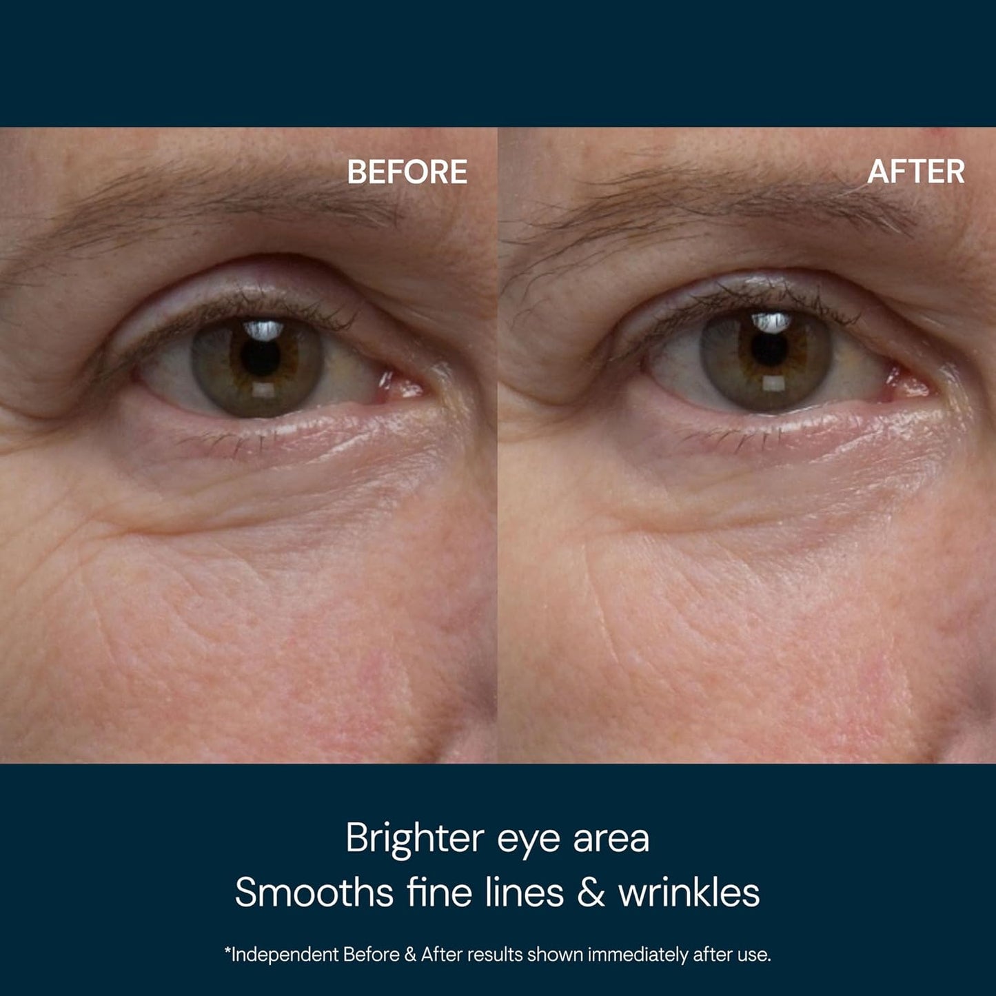 ELEMIS Pro-Collagen Eye Treatment, Eye Revive Mask, Vitality Eye Cream, Under Eye Gel Mask – Anti-Aging